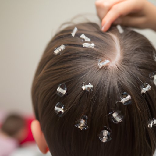 How Does Someone Get Lice? Exploring Common Causes & Prevention The Enlightened Mindset