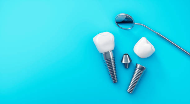 Dental implants